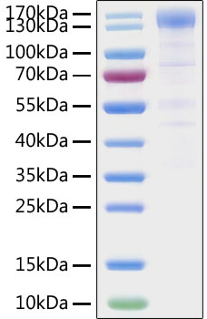 Recombinant SARS-CoV-2 Spike S1 Protein was determined by SDS-PAGE under reducing conditions with Coomassie Blue.