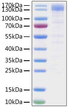 Recombinant SARS-CoV-2 Spike S1 Protein was determined by SDS-PAGE under reducing conditions with Coomassie Blue.