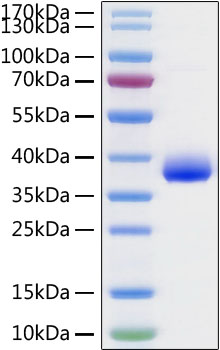 Recombinant SARS-CoV-2 Spike RBD Protein was determined by SDS-PAGE under reducing conditions with Coomassie Blue.