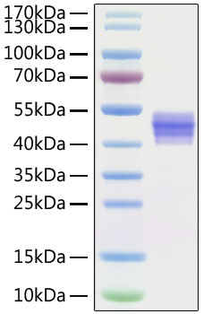 Recombinant Human IL-12B/IL-12 p40 Protein was determined by SDS-PAGE under reducing conditions with Coomassie Blue.
