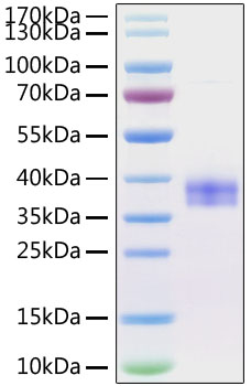 Recombinant Mouse Siglec-15/CD33L3 Protein was determined by SDS-PAGE under reducing conditions with Coomassie Blue.