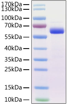 Recombinant Mouse Siglec-15/CD33L3 Protein was determined by SDS-PAGE under reducing conditions with Coomassie Blue.