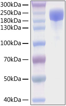 Recombinant SARS-CoV-2 Spike S1+S2 ECD(S-ECD)(D614G) Protein was determined by SDS-PAGE under reducing conditions with Coomassie Blue.