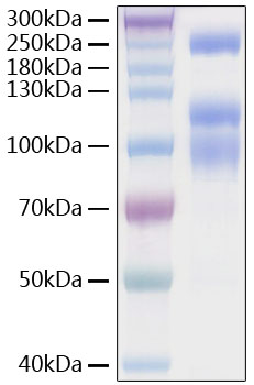 Recombinant SARS-CoV-2 Spike S1+S2 ECD(S-ECD)(D614G) Protein was determined by SDS-PAGE under reducing conditions with Coomassie Blue.