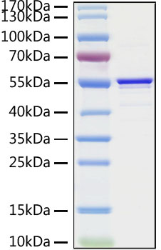 Recombinant SARS-CoV Nucleocapsid Protein was determined by SDS-PAGE under reducing conditions with Coomassie Blue.