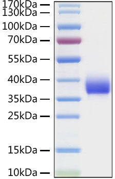 Recombinant SARS-CoV Spike RBD Protein was determined by SDS-PAGE under reducing conditions with Coomassie Blue.