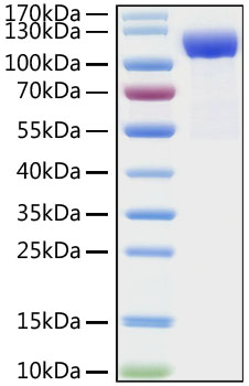 Recombinant Human DPP4/CD26 Protein was determined by SDS-PAGE under reducing conditions with Coomassie Blue.