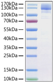 Recombinant SARS-CoV Spike S1 Protein was determined by SDS-PAGE under reducing conditions with Coomassie Blue.
