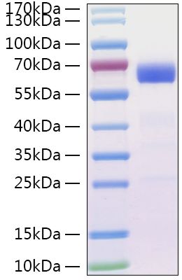 Recombinant SARS-CoV Spike RBD Protein was determined by SDS-PAGE under reducing conditions with Coomassie Blue.