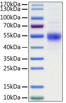 Recombinant Human CD19 Protein was determined by SDS-PAGE under reducing conditions with Coomassie Blue.