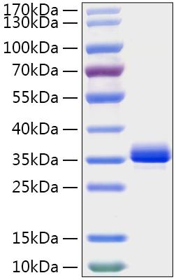 Recombinant Mouse Noggin/NOG Protein was determined by SDS-PAGE under reducing conditions with Coomassie Blue.