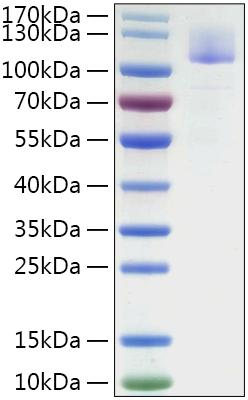 Recombinant SARS-CoV Spike S1 Protein was determined by SDS-PAGE under reducing conditions with Coomassie Blue.