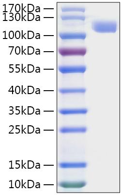 Recombinant MERS-CoV Spike S1 Protein was determined by SDS-PAGE under reducing conditions with Coomassie Blue.