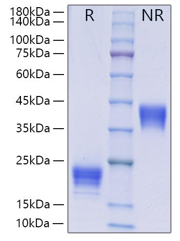 Recombinant Human IL-5 Protein was determined by SDS-PAGE under reducing (R) and non-reducing (NR) conditions.