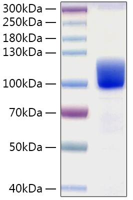Recombinant Human Tyrosine-protein kinase receptor UFO/Axl Protein was determined by SDS-PAGE under reducing conditions with Coomassie Blue.