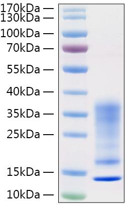 Recombinant Human IL-13 Protein was determined by SDS-PAGE under reducing conditions with Coomassie Blue.