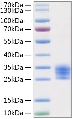 Recombinant Mouse IL-6 Protein was determined by SDS-PAGE under reducing conditions with Coomassie Blue.