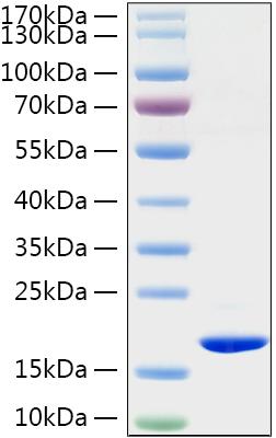 Recombinant Rat TNF-alpha Protein was determined by SDS-PAGE under reducing conditions with Coomassie Blue.