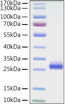 Recombinant Mouse TNFRSF5/CD40 Protein was determined by SDS-PAGE under reducing conditions with Coomassie Blue.