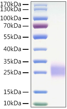 Recombinant Mouse CTLA-4/CD152 Protein was determined by SDS-PAGE under reducing conditions with Coomassie Blue.