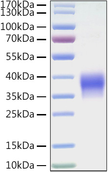 Recombinant Mouse B7-H5/Gi24/VISTA Protein was determined by SDS-PAGE under reducing conditions with Coomassie Blue.