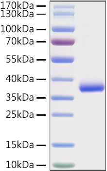 Recombinant SARS-COV-2 Spike RBD(K417N) Protein was determined by SDS-PAGE under reducing conditions with Coomassie Blue.