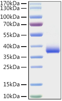 Recombinant SARS-COV-2 Spike RBD(E484K) Protein was determined by SDS-PAGE under reducing conditions with Coomassie Blue.