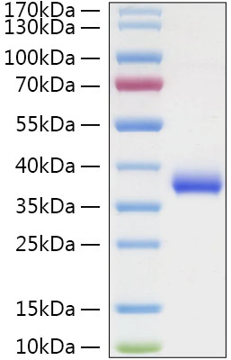 Recombinant SARS-COV-2 Spike RBD(N501Y) Protein was determined by SDS-PAGE under reducing conditions with Coomassie Blue.