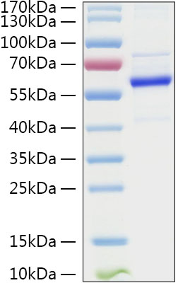 Recombinant Human TET2 Protein was determined by SDS-PAGE under reducing conditions with Coomassie Blue.