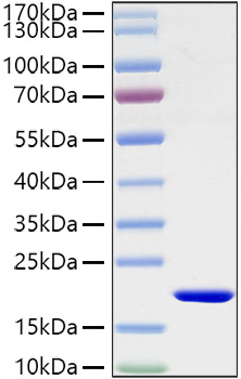 Recombinant Mouse IL-1 beta Protein was determined by SDS-PAGE under reducing conditions with Coomassie Blue.