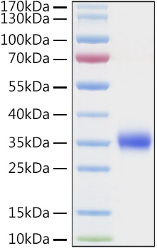 Recombinant Human TIMP-1 Protein was determined by SDS-PAGE under reducing conditions with Coomassie Blue.