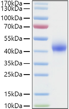 Recombinant Human Dkk-1 Protein was determined by SDS-PAGE under reducing conditions with Coomassie Blue.