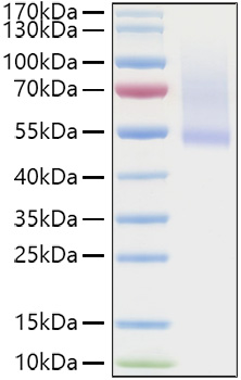 Recombinant Human Decorin/PG-S2/DCN Protein was determined by SDS-PAGE under reducing conditions with Coomassie Blue.