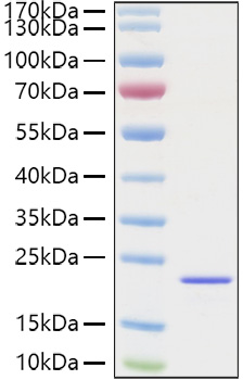 Recombinant Mouse FGF-2/bFGF Protein was determined by SDS-PAGE under reducing conditions with Coomassie Blue.