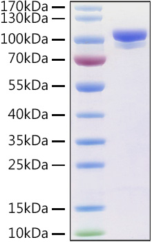 Recombinant Human Prolyl endopeptidase FAP Protein was determined by SDS-PAGE under reducing conditions with Coomassie Blue.