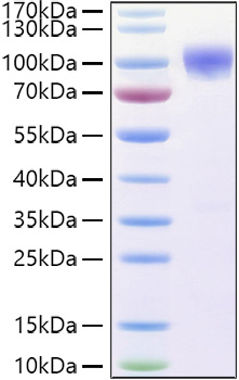 Recombinant Human TNFRSF21/DR6/CD358 Protein was determined by SDS-PAGE under reducing conditions with Coomassie Blue.