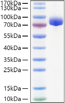 Recombinant Human APLP-1 Protein was determined by SDS-PAGE under reducing conditions with Coomassie Blue.