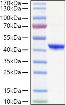 Recombinant Human YKL-40/CHI3L1 Protein was determined by SDS-PAGE under reducing conditions with Coomassie Blue.