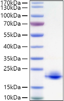 Recombinant Human Myelin oligodendrocyte glycoprotein/MOFG Protein was determined by SDS-PAGE under reducing conditions with Coomassie Blue.