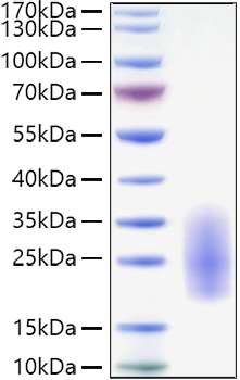 Recombinant Human IL-3 Protein was determined by SDS-PAGE under reducing conditions with Coomassie Blue.