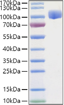 Recombinant Human ROBO4 Protein was determined by SDS-PAGE under reducing conditions with Coomassie Blue.