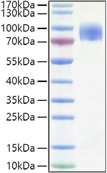 Recombinant Human CD200R1 Protein was determined by SDS-PAGE under reducing conditions with Coomassie Blue.
