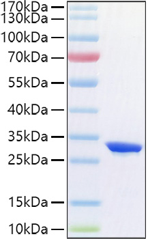 Recombinant Human Complement factor D/CFD Protein was determined by SDS-PAGE under reducing conditions with Coomassie Blue.