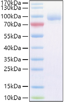 Recombinant Human Vasorin/SLITL2/VASN Protein was determined by SDS-PAGE under reducing conditions with Coomassie Blue.