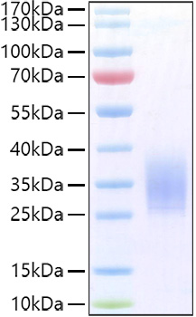 Recombinant Human PTH1R Protein was determined by SDS-PAGE under reducing conditions with Coomassie Blue.