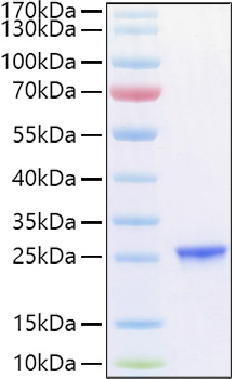 Recombinant Human TIMP-2 Protein was determined by SDS-PAGE under reducing conditions with Coomassie Blue.