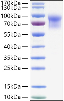 Recombinant Mouse IL-15RA/CD215 Protein was determined by SDS-PAGE under reducing conditions with Coomassie Blue.