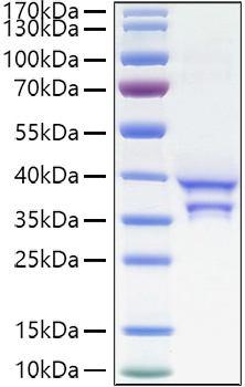 Recombinant Human CCL17/TARC Protein was determined by SDS-PAGE under reducing conditions with Coomassie Blue.