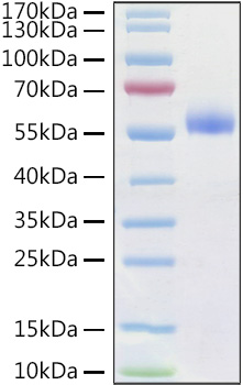 Recombinant Human Frizzled-4/FZD4/CD344 Protein was determined by SDS-PAGE under reducing conditions with Coomassie Blue.