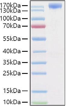 Recombinant Human VEGFR-2/KDR/CD309 Protein was determined by SDS-PAGE under reducing conditions with Coomassie Blue.